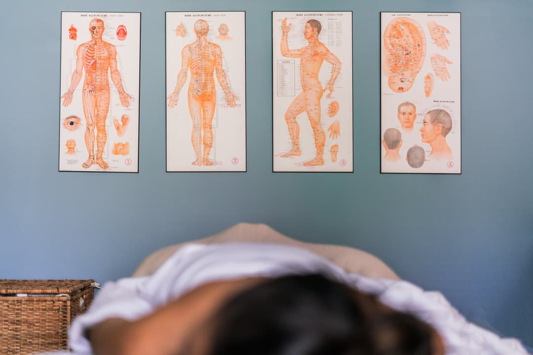 Acupuncture with human body reference charts